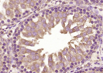 UCHL3 Rabbit Polyclonal Antibody