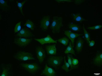 VAX1 Rabbit Polyclonal Antibody