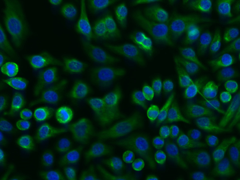 Vimentin Rabbit Polyclonal Antibody