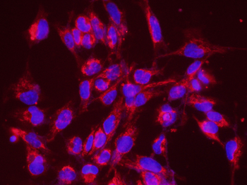 TUBB3 (Neuronal Marker) Rabbit Polyclonal Antibody (BF594)