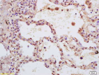 ZFX Rabbit Polyclonal Antibody