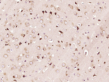 ZFYVE27 Rabbit Polyclonal Antibody