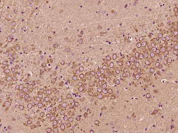 ZFYVE27 Rabbit Polyclonal Antibody