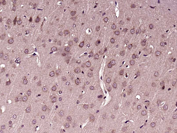 ZIC3 Rabbit Polyclonal Antibody