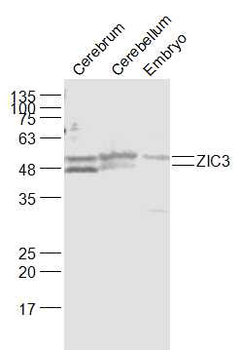 ZIC3 Rabbit Polyclonal Antibody