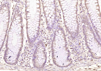 ZMYM2 Rabbit Polyclonal Antibody
