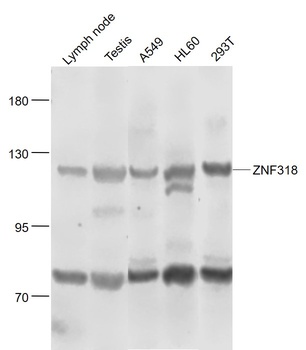 ZNF318 Rabbit Polyclonal Antibody
