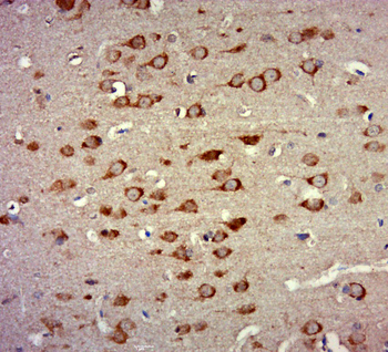 ZNF346 Rabbit Polyclonal Antibody