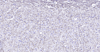 MBP Ready-To-Use IHC Kit