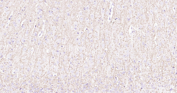 MBP Ready-To-Use IHC Kit