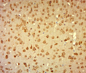 Laminin alpha 1 Rabbit Polyclonal Antibody