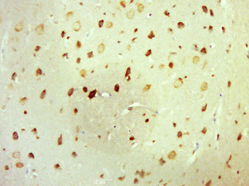 Laminin alpha 1 Rabbit Polyclonal Antibody