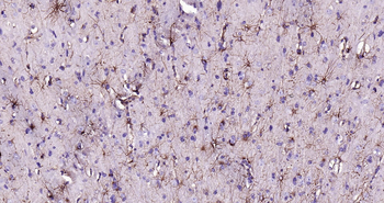 GFAP Ready-To-Use IHC Kit