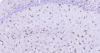 GFAP Ready-To-Use IHC Kit