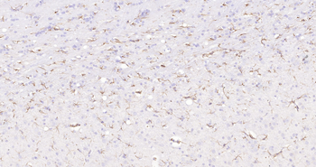 GFAP Ready-To-Use IHC Kit