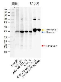 HPV16 E7 Rabbit Polyclonal Antibody