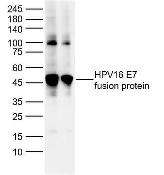 HPV16 E7 Rabbit Polyclonal Antibody