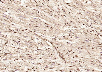 Gemin 6 Rabbit Polyclonal Antibody