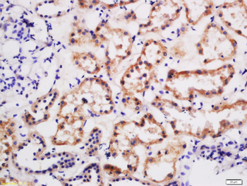 BTR1 Rabbit Polyclonal Antibody