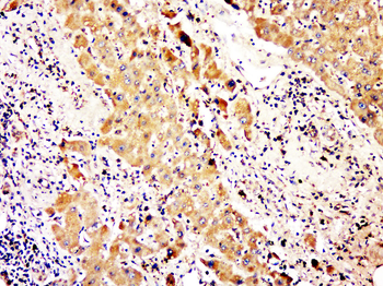 C2orf65 Rabbit Polyclonal Antibody