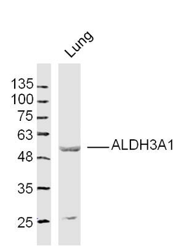ALDH3A1 Rabbit Polyclonal Antibody