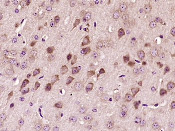 VWF Rabbit Polyclonal Antibody