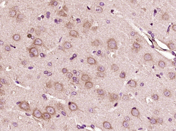 VWF Rabbit Polyclonal Antibody