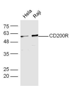 CD200R Rabbit Polyclonal Antibody