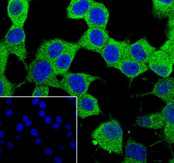 STIP1 Recombinant Rabbit Monoclonal Antibody