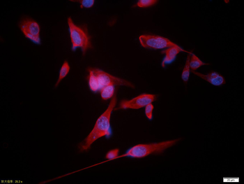 Vimentin Rabbit Polyclonal Antibody (BF594)