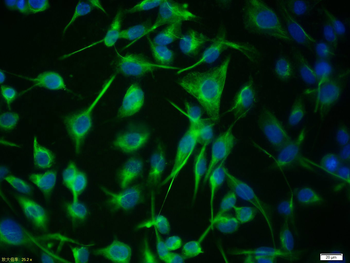 Vimentin Rabbit Polyclonal Antibody (BF488)