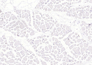 CD5 Mouse Monoclonal Antibody