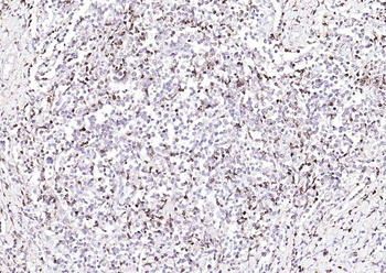 CD5 Mouse Monoclonal Antibody