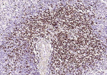 CD5 Mouse Monoclonal Antibody