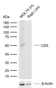 CD5 Mouse Monoclonal Antibody