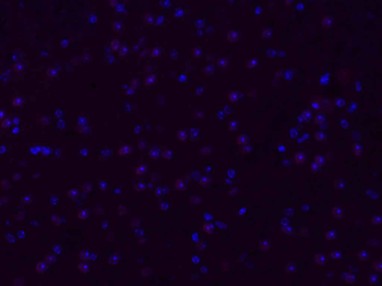 GSTP1 Rabbit Polyclonal Antibody (BF594)