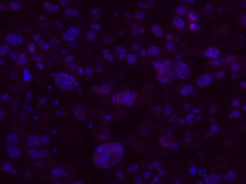 GSTP1 Rabbit Polyclonal Antibody (BF594)
