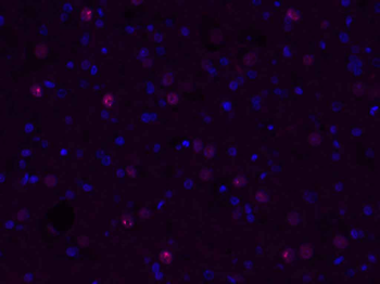 GSTP1 Rabbit Polyclonal Antibody (BF594)