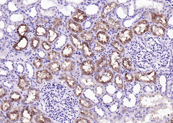 RBP4 Mouse Monoclonal Antibody