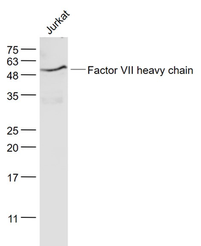 Factor VII heavy chain Rabbit Polyclonal Antibody