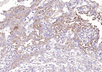 Mesothelin Rabbit Polyclonal Antibody