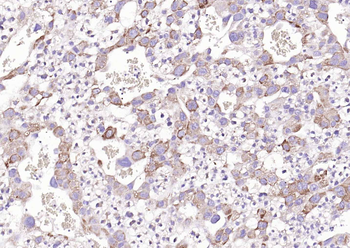 Mesothelin Rabbit Polyclonal Antibody