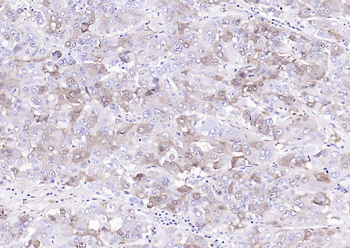 Vitamin D Binding protein Mouse Monoclonal Antibody