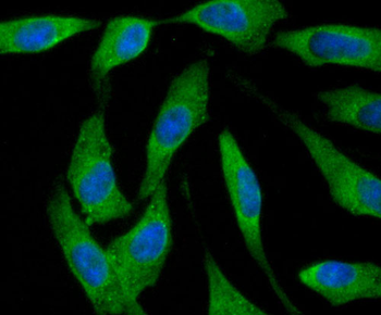 Ferritin Heavy Chain Recombinant Rabbit Monoclonal Antibody
