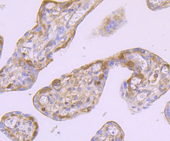Ferritin Heavy Chain Recombinant Rabbit Monoclonal Antibody