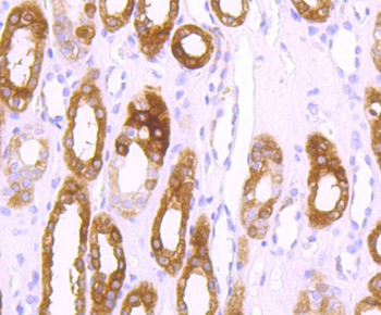 Ferritin Heavy Chain Recombinant Rabbit Monoclonal Antibody