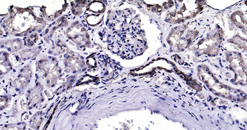 Human Calbindin Ready-To-Use IHC Kit