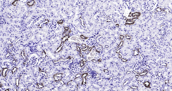 Calbindin Ready-To-Use IHC Kit