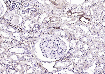 CD39/ENTPD1 Recombinant Rabbit Monoclonal Antibody