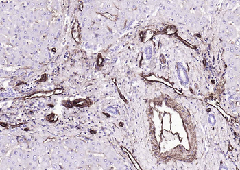 CD39/ENTPD1 Recombinant Rabbit Monoclonal Antibody